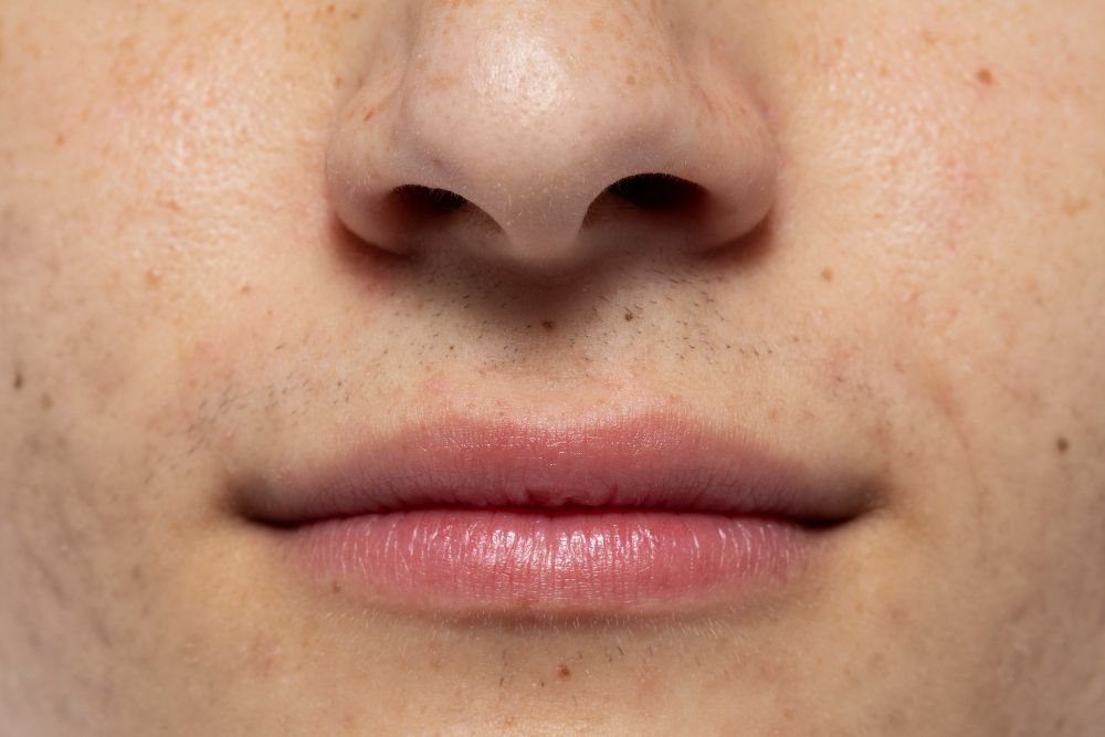 Kenapa Kulit Kering & Kusam Setelah Liburan?