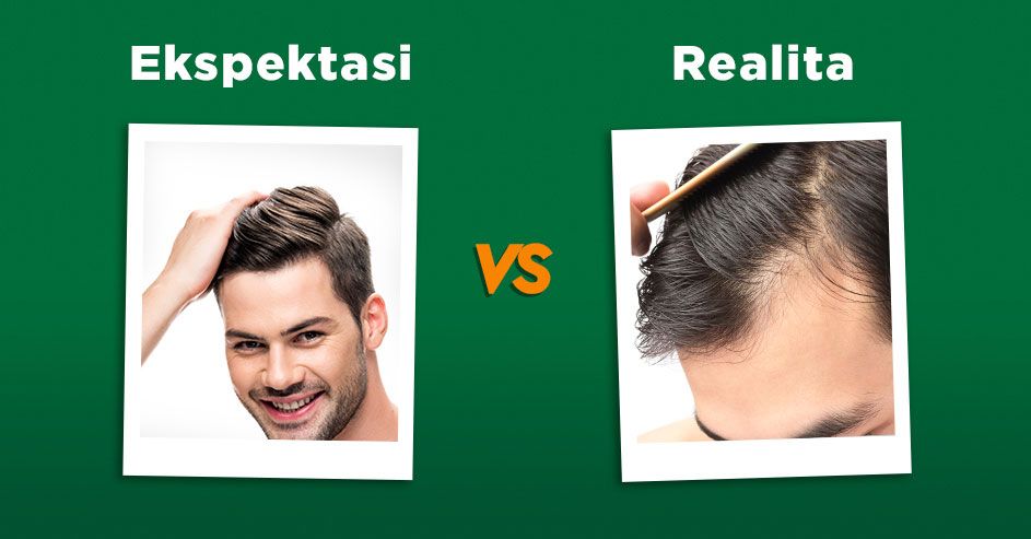 Rambut Kuat vs Rambut Lepek