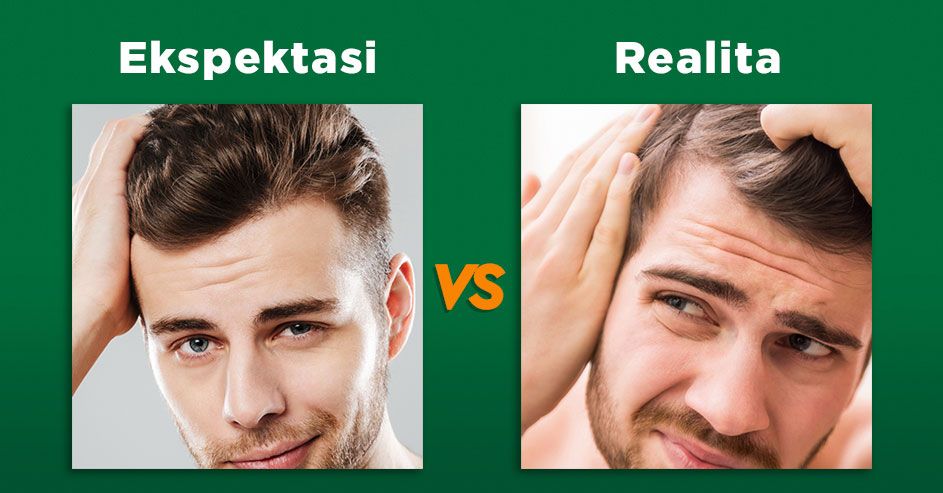 Rambut Sehat Vs. Rambut Rusak
